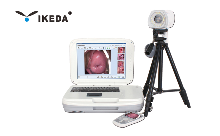 數碼電子陰道鏡常見的故障及原因 數碼電子陰道鏡常見的故障及原因