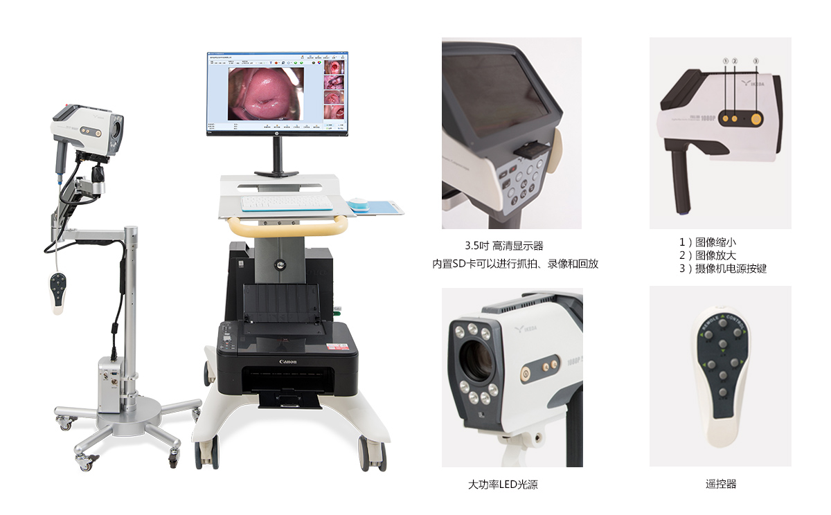 數碼電子陰道鏡打開無圖像顯示 數碼電子陰道鏡打開無圖像顯示