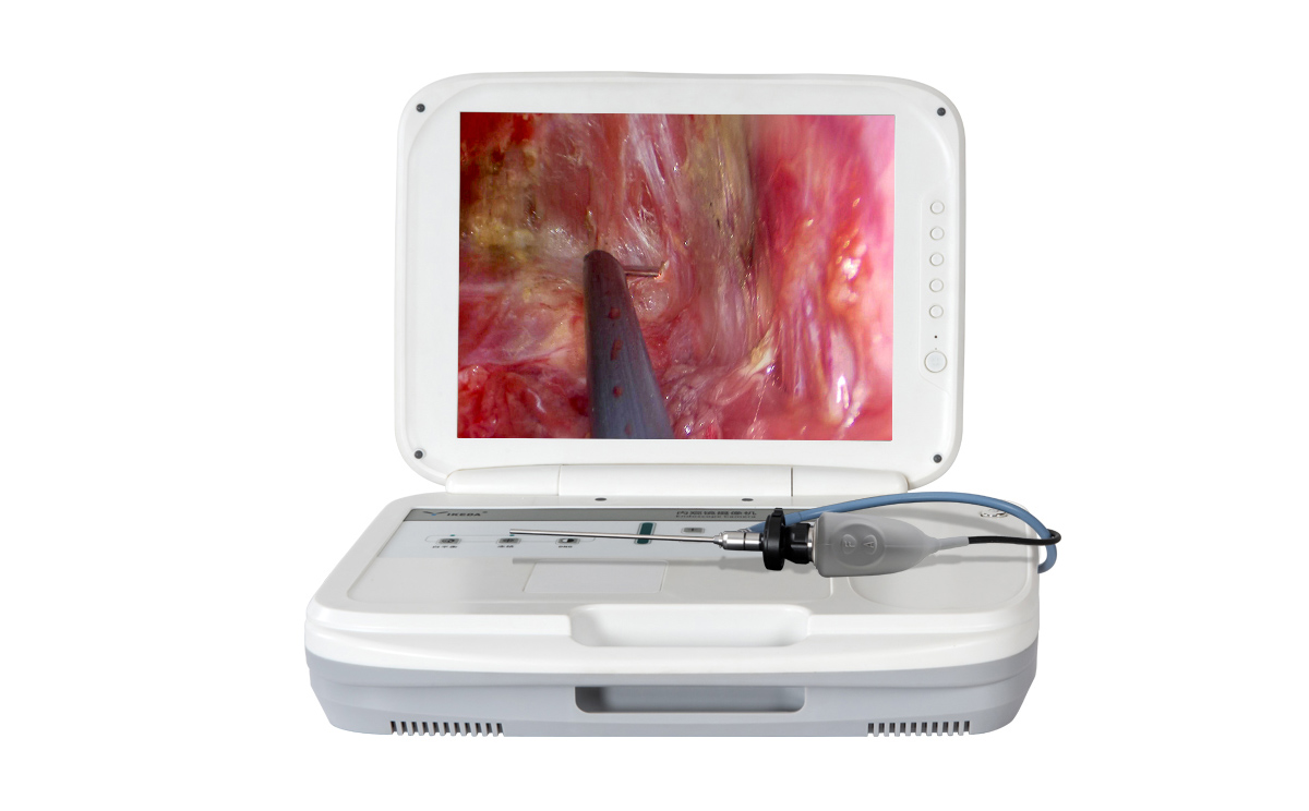 醫用內窺鏡攝像機的優點 醫用內窺鏡攝像機的優點