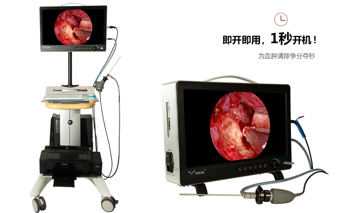 動(dòng)物耳鼻喉內(nèi)窺鏡應(yīng)用 動(dòng)物耳鼻喉內(nèi)窺鏡應(yīng)用