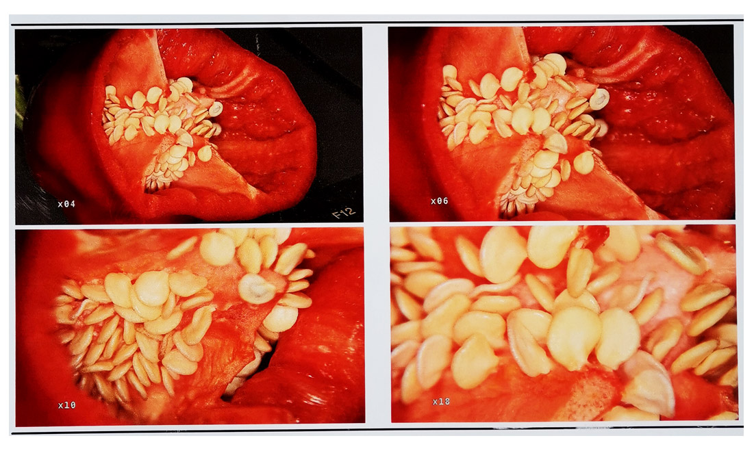 電子陰道鏡放大倍率是多少？