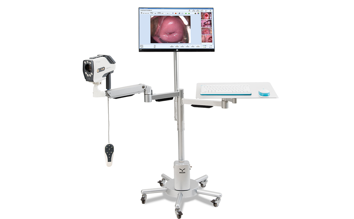 數(shù)碼電子陰道鏡如何選擇?根據(jù)醫(yī)院等級(jí)需求選擇合適的 數(shù)碼電子陰道鏡如何選擇?根據(jù)醫(yī)院等級(jí)需求選擇合適的