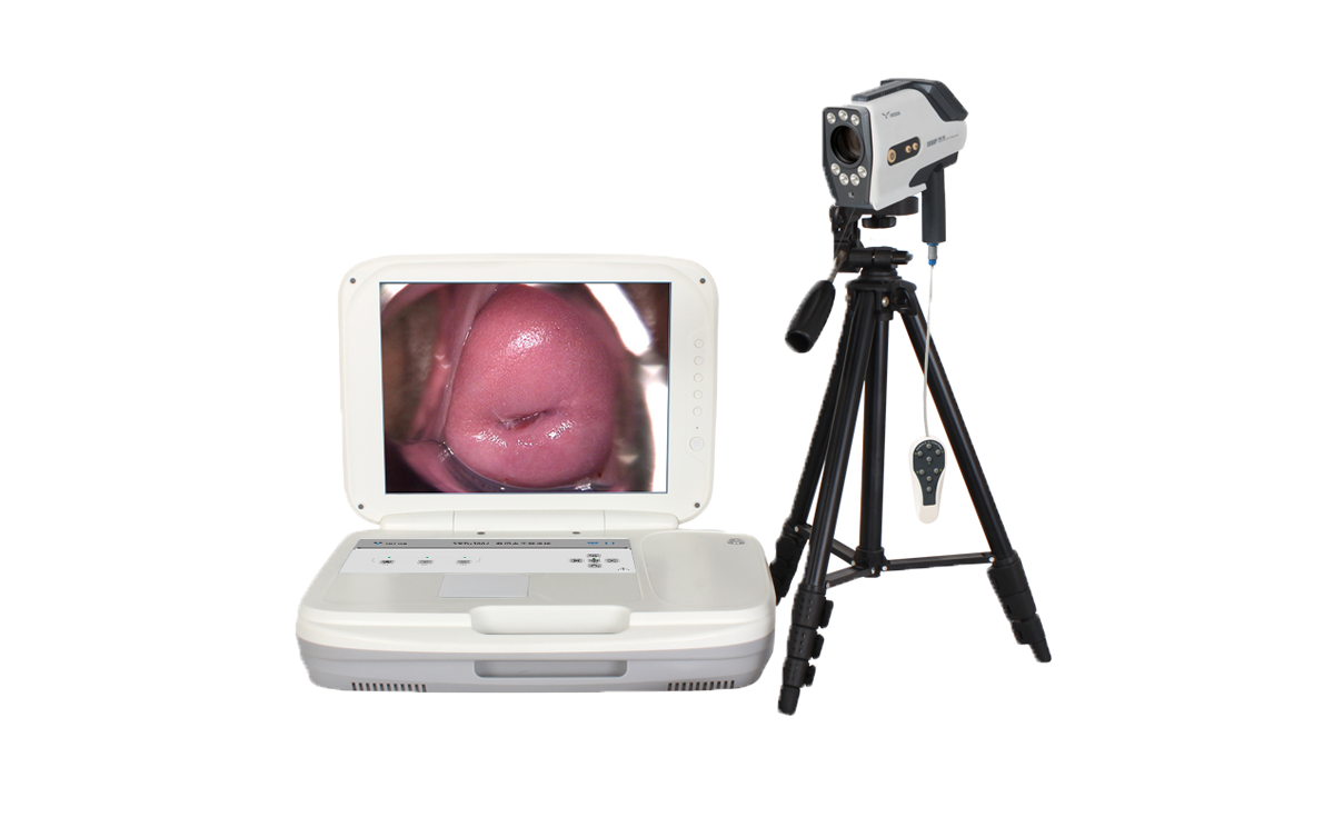 數(shù)碼電子陰道鏡如何選擇?根據(jù)醫(yī)院等級(jí)需求選擇合適的 數(shù)碼電子陰道鏡如何選擇?根據(jù)醫(yī)院等級(jí)需求選擇合適的