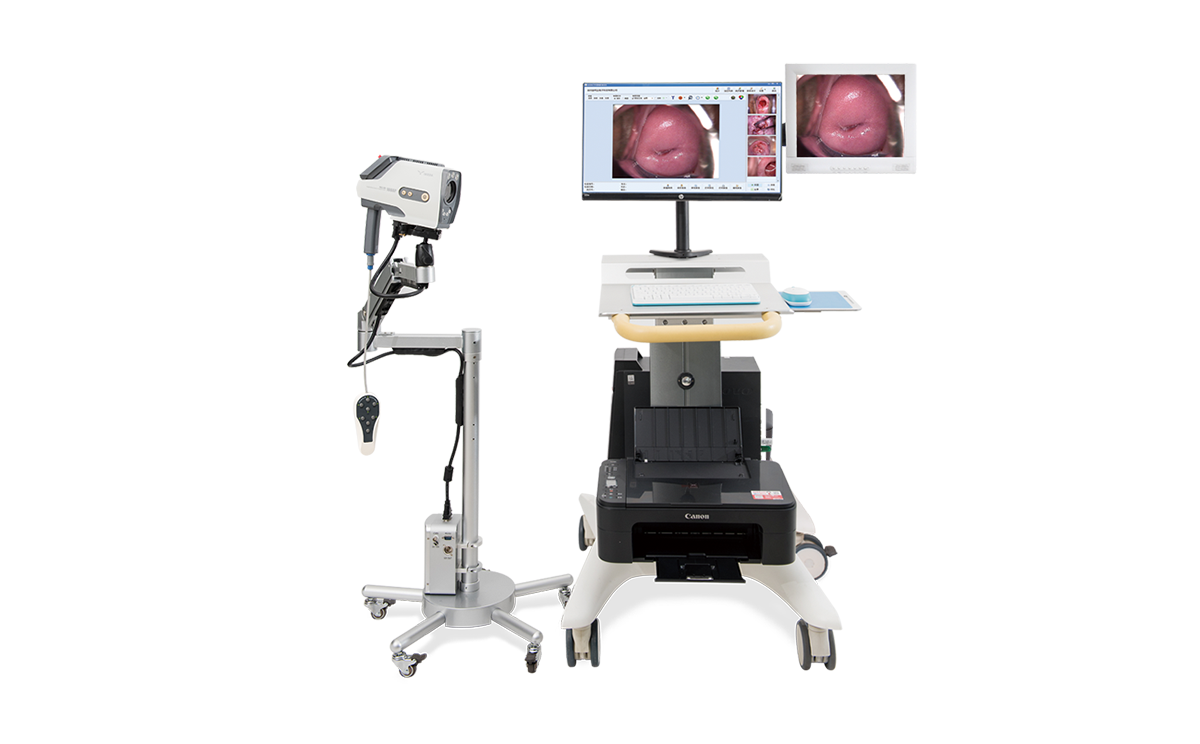 數(shù)碼電子陰道鏡如何選擇?根據(jù)醫(yī)院等級(jí)需求選擇合適的 數(shù)碼電子陰道鏡如何選擇?根據(jù)醫(yī)院等級(jí)需求選擇合適的