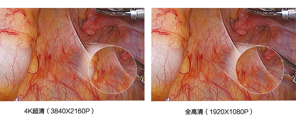 益柯達4K超高清內窺鏡攝像系統 益柯達4K超高清內窺鏡攝像系統