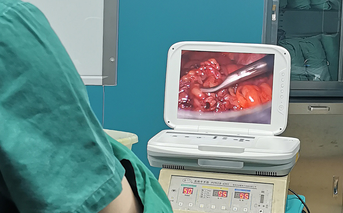 【腹腔鏡篇】腹腔鏡疝氣手術(shù),您知道嗎? 【腹腔鏡篇】腹腔鏡疝氣手術(shù),您知道嗎?