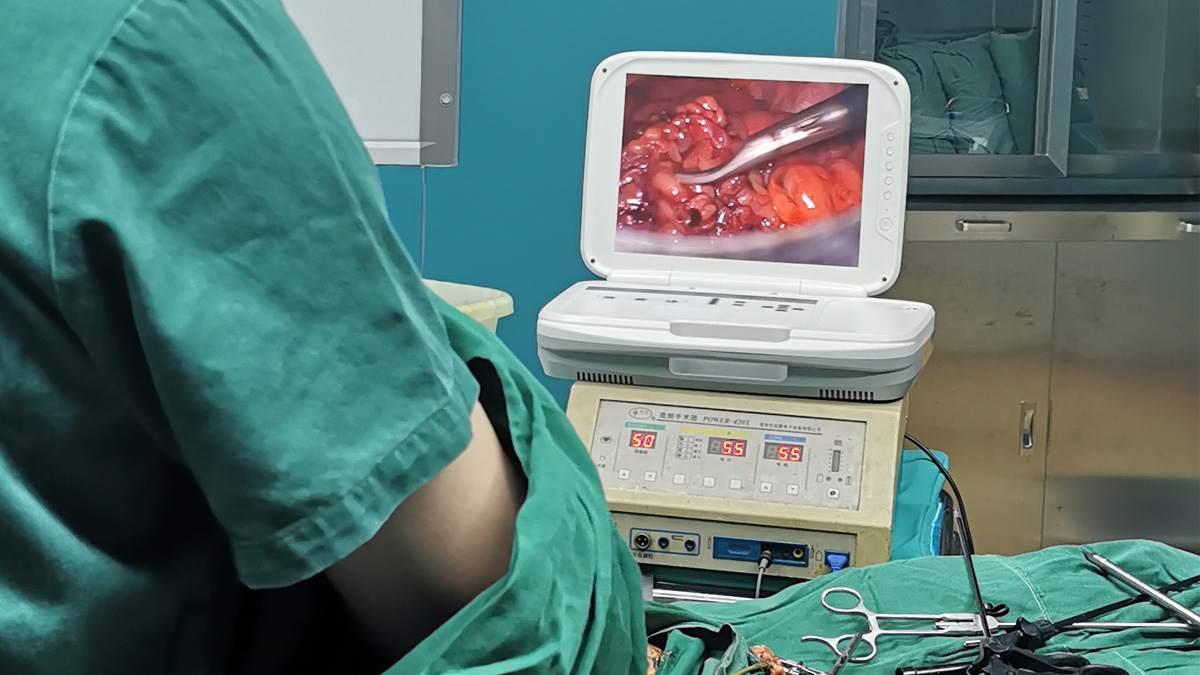 內窺鏡攝像機適用于哪些科室范圍? 內窺鏡攝像機適用于哪些科室范圍?