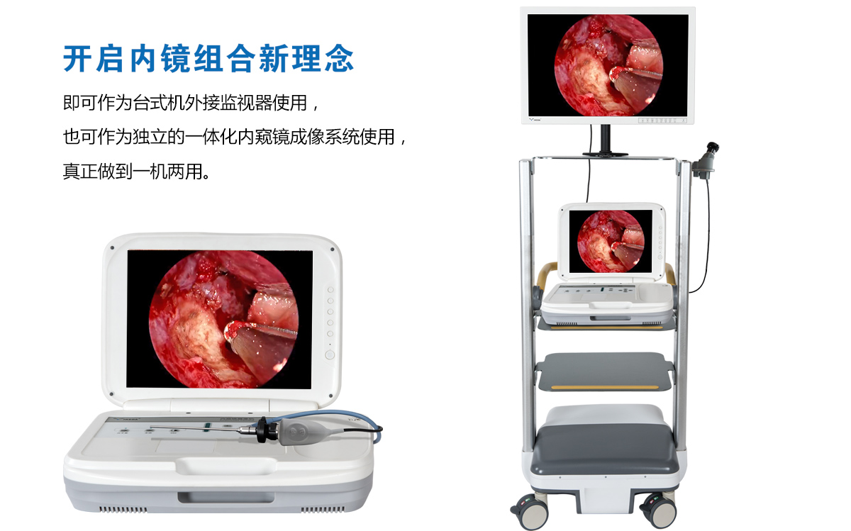 用戶反饋:YKD-9003內(nèi)窺鏡攝像機(jī)獲得好評 用戶反饋:YKD-9003內(nèi)窺鏡攝像機(jī)獲得好評