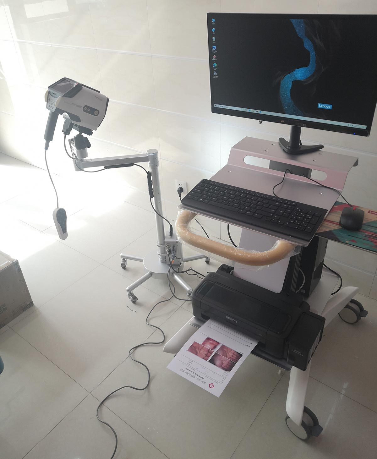 益柯達YKD-3001數碼電子陰道鏡裝機 益柯達YKD-3001數碼電子陰道鏡裝機