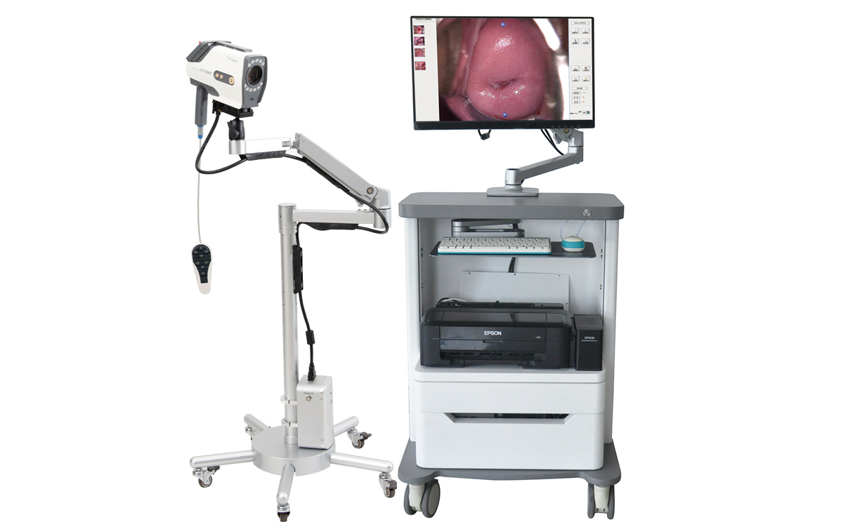 數碼電子陰道鏡 數碼電子陰道鏡