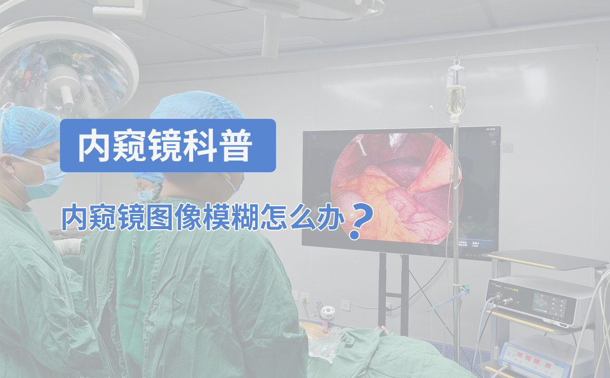 內(nèi)窺鏡科普:內(nèi)窺鏡圖像模糊怎么辦? 內(nèi)窺鏡科普:內(nèi)窺鏡圖像模糊怎么辦?