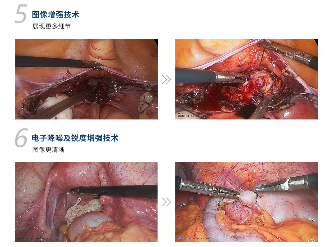 4K醫(yī)用內窺鏡攝像系統(tǒng) YKD-9210