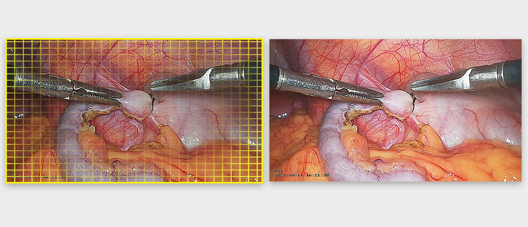 4K熒光內窺鏡攝像系統