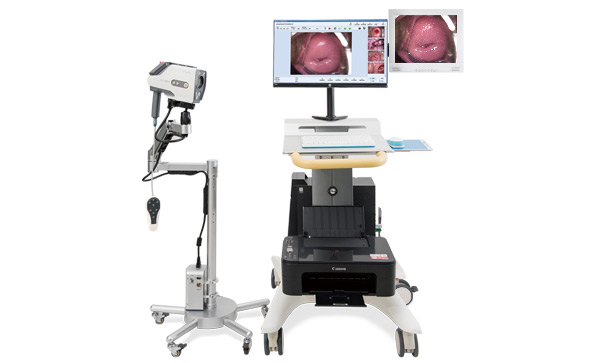 如何選擇數(shù)碼電子陰道鏡？