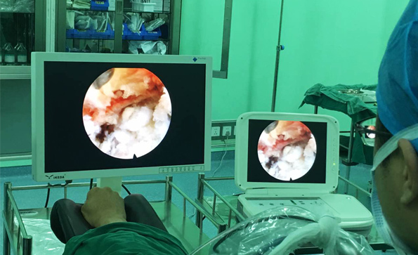 如何維護保養內窺鏡顯示器？