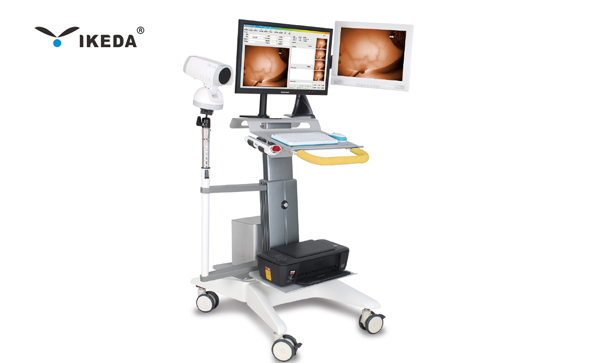 紅外乳腺檢查儀是什么？