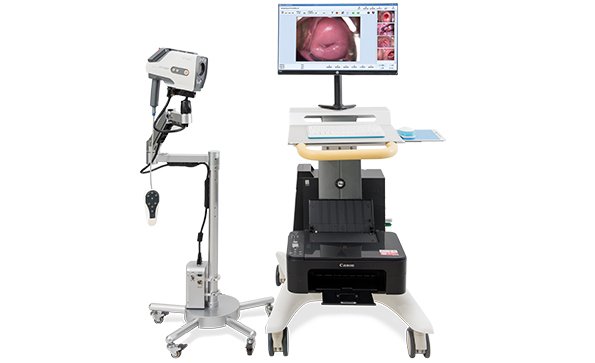 電子陰道鏡鏡頭哪家好？