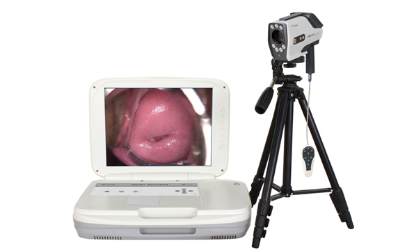 陰道鏡選擇：便攜式陰道鏡選擇哪家好？