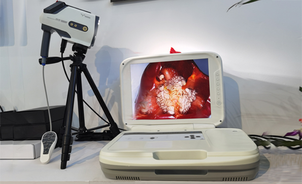 數(shù)碼電子陰道鏡怎么樣？數(shù)碼電子陰道鏡準嗎？