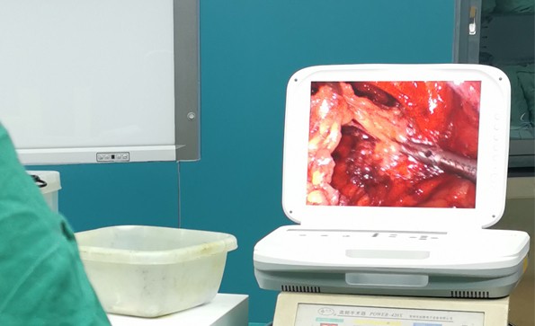 【腹腔鏡篇】腹腔鏡疝氣手術，您知道嗎？