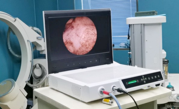 一文了解關(guān)節(jié)鏡系統(tǒng)的構(gòu)成、應(yīng)用、操作流程